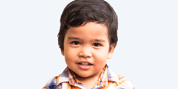 Hunter Syndrome