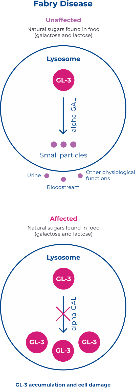 Fabry disease chart