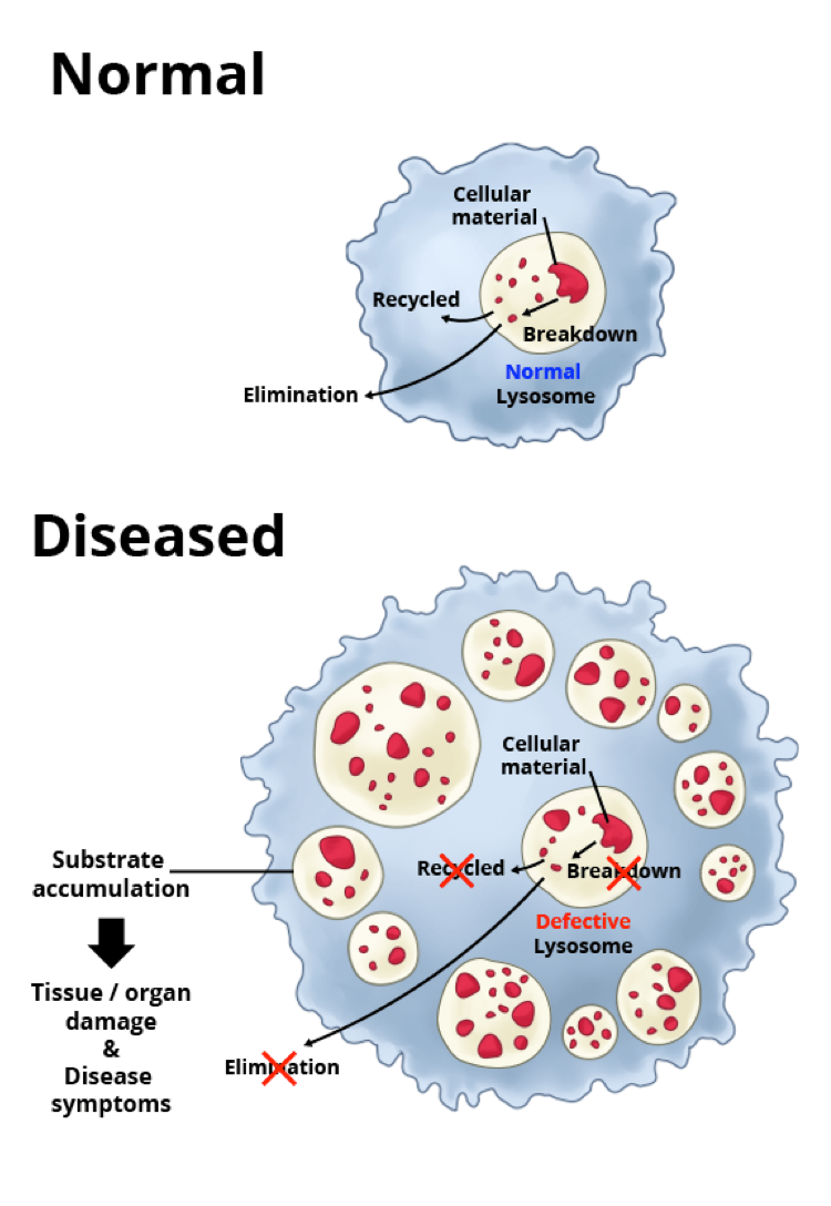 lysosomes